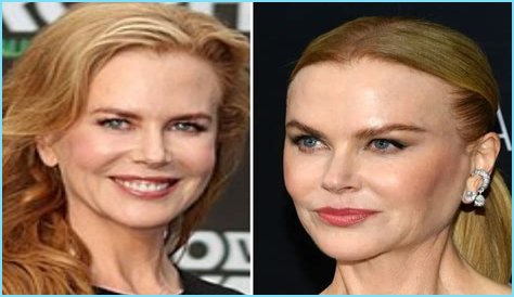 Nicole Kidman's 